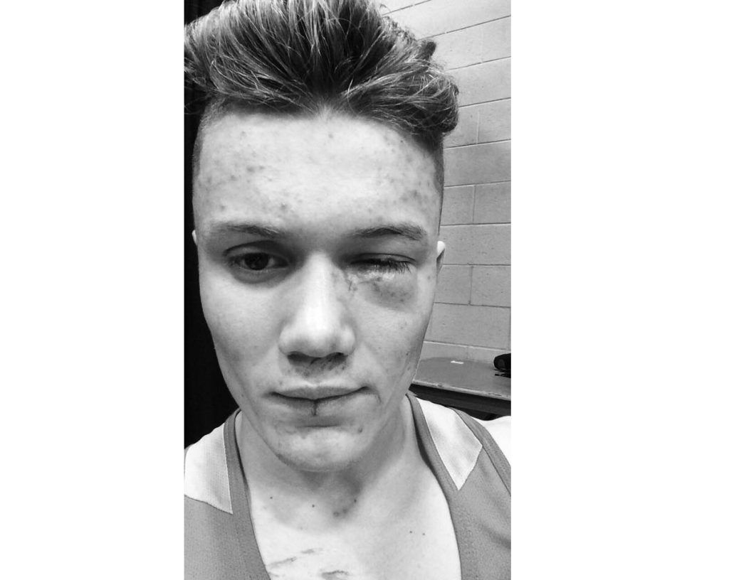 Thomas Chabot évite la catastrophe de près Courrier Frontenac